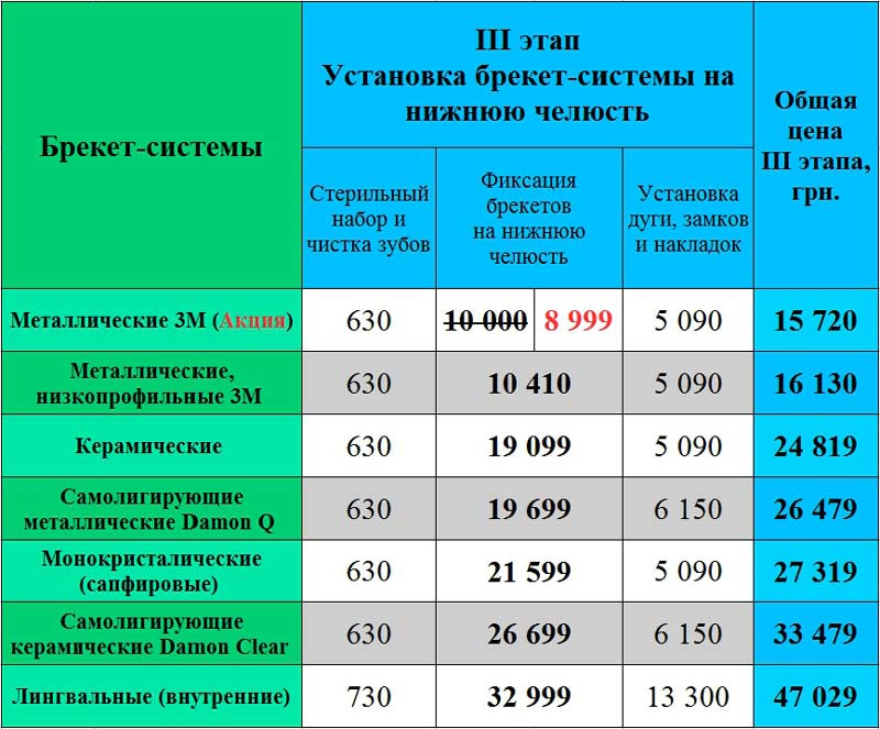 Установка брекет-системы цена Киев ЛюмиДент
